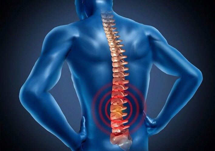 a nyaki gerinc osteochondrosisa férfiaknál repedező térdfájdalom